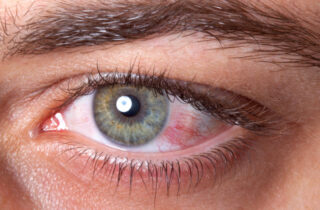 Почему у наркоманов красные глаза: опасно ли это
