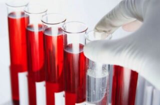 Анализ крови на хронический алкоголизм: расшифровка