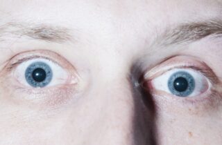 Как могут выглядеть глаза наркомана: примеры